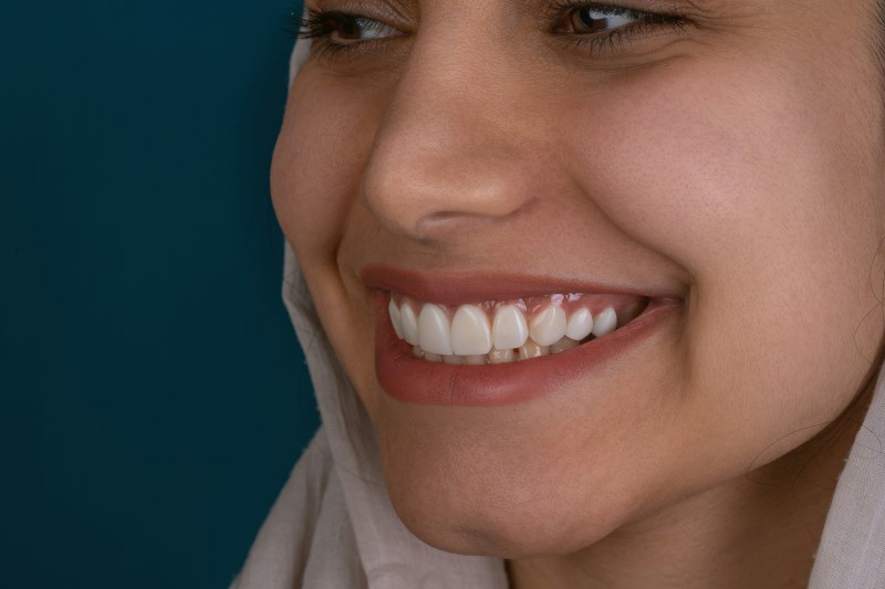 dental implants cost without insurance